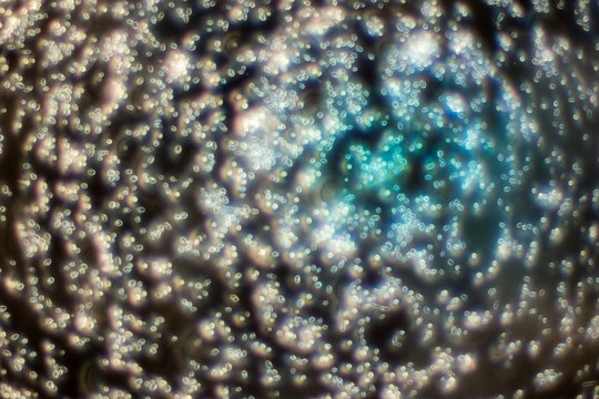 Yeast under the microscope.