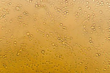 Yeast under the microscope.