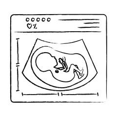 monochrome blurred silhouette of ultrasound of baby