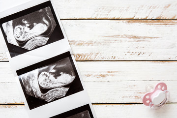Ultrasound and pacifier on wooden background

