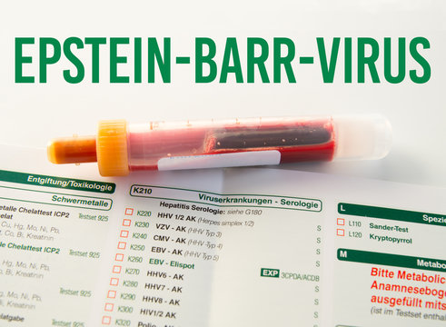 Epstein-Barr-Virus / Blutprobe bei Blutabnahme