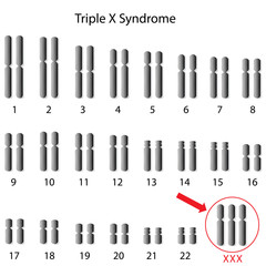 Triple X syndrome