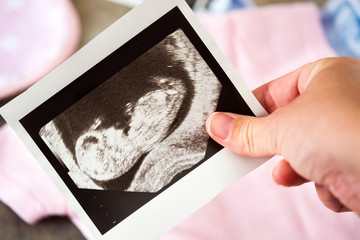 Pregnant woman showing a ultrasound scan

