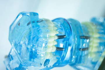 Dental teeth student model