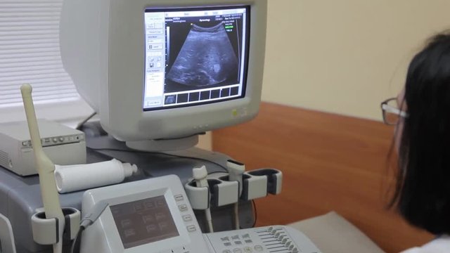 A female doctor is working behind an ultrasound diagnostic tool. Medical technologies. ultrasound device