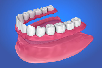 All missing teeth - removable full denture. 3D illustration