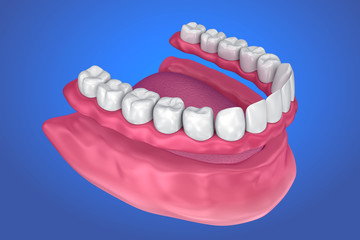All missing teeth - removable full denture. 3D illustration