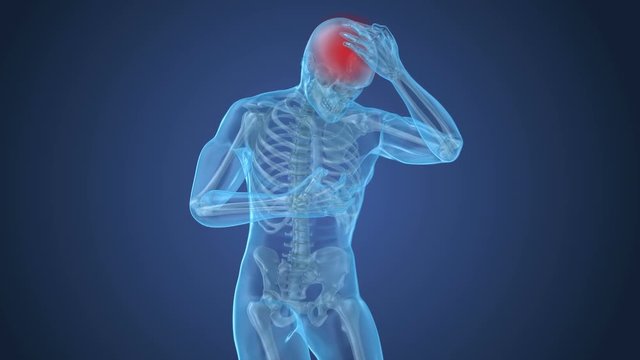Head pain Attack, man suffering from brain pain. 3D animation