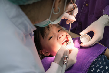 Obraz na płótnie Canvas Dentist polishing asian girls teeth.