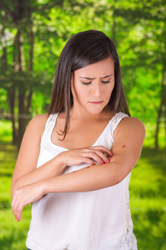 Close up of young woman suffering from itch after mosquito bites, in a blurred background