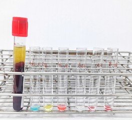 ABO blood grouping by tube method (Forward grouping and reverse grouping).