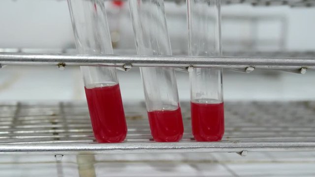 Close up blood in testube blood group testing concept.