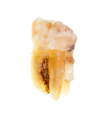 Old torn tooth on a white background
