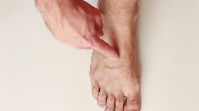 Fingering vitiligo skin on foot