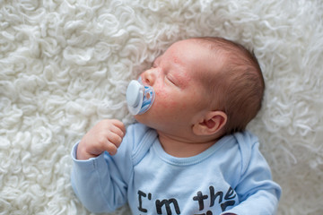 Little newborn baby sleeping, baby with scin rash © Tomsickova