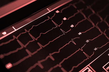 cardiogram close-up on a cardiograph monitor