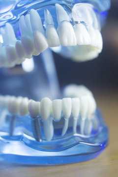 Dental teeth mouth health