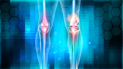 Joint problems bright abstract design, burning damaged knee 