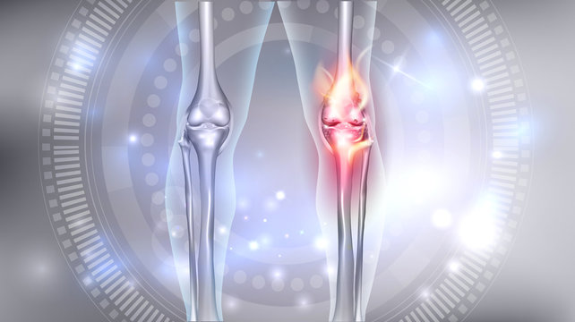 Joint problems bright abstract design, burning damaged knee 