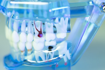 Dental teeth dentist model
