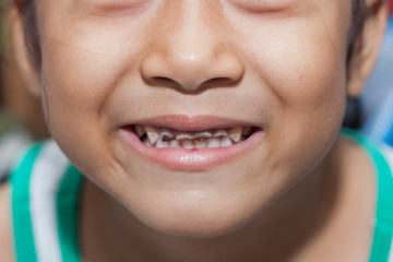Smiling child