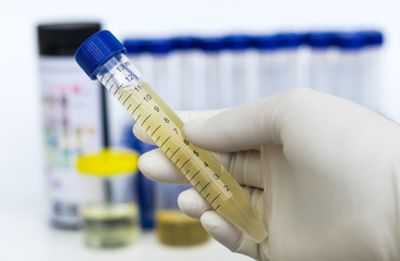 tube of urine test tube in hand,Healthcare And Medicine. Medical urine test, close-up,