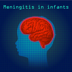 Meningitis in infants. Vector medical illustration. Kid, baby, childhood. Dark blue science background, blue silhouette of child head, anatomy image of brain.