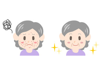 吹き出物に悩むシニア女性のイラスト: ビフォーアフター 