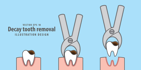 Fototapeta premium Decay tooth removal illustration vector on blue background. Dental concept.