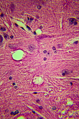 Images of biological tissues in a microscope. Real photo, blur zones possible