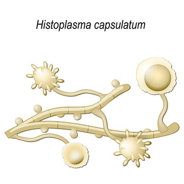 Histoplasma capsulatum