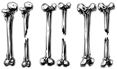 Graphic black and white broken bones vector set