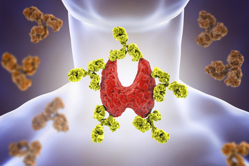 Autoimmune thyroiditis, Hashimoto's disease. 3D illustration showing antibodies attacking thyroid gland