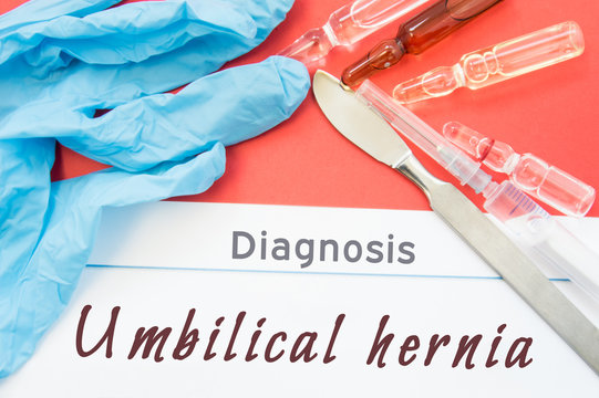 Diagnosis Umbilical hernia. Blue gloves, surgical scalpel, syringe and ampoule with medicine lie next to inscription Umbilical hernia. Causes, symptoms, diagnosis, treatment, diet of surgical disease