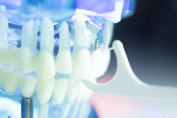 Dental teeth dentist impant