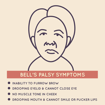 Bell's Palsy Vector Icon Illustration