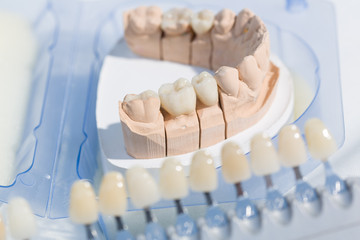 Fototapeta na wymiar Prothesensattel mit Zahnersatz im Zahnlabor wird farblich abgeglichen