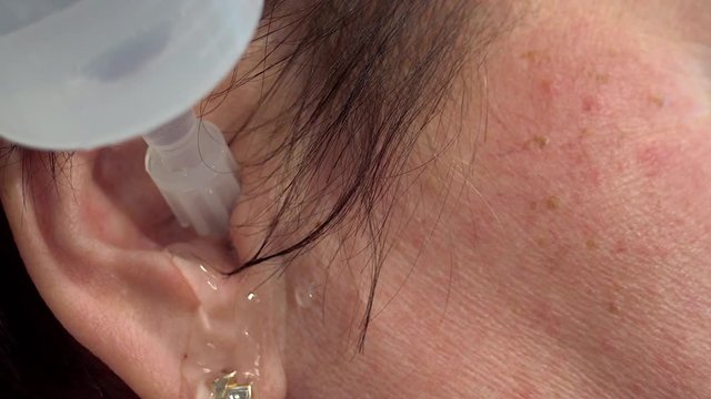 Putting water inside the ear for ear rinsing it is a treatment to take care of the ear of a human