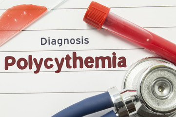 Diagnosis of Polycythemia. Medical book with text header hematological diagnosis Polycythemia lies...