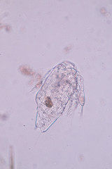 Copepods are a group of small crustaceans found in the sea and nearly every freshwater habitat. 