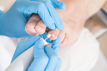 Pielęgnacja stóp. Podologia.