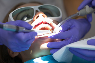 Dental laser used on a patient on soft and hard tissue. Dental health, modern technology and oral...