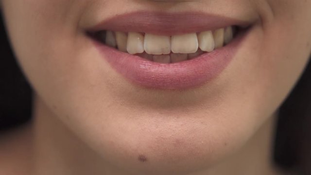 Pretty brunette woman smiling at the spa salon. macro close up of female mouth. Attractive caucasian girl shows her white teeth