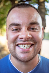 Fototapeta premium Young man in a blue T-shirt with a chipped tooth