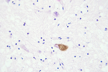 Brain tissue microscopic view magnification x400