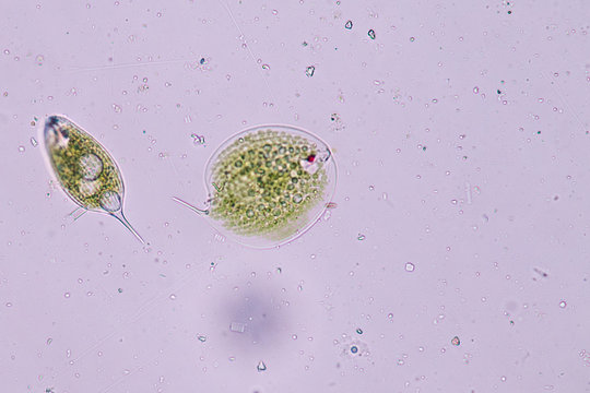 Phacus is a genus of unicellular protists, of the phylum Euglenozoa.