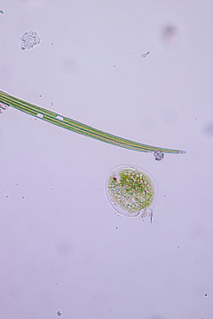 Phacus is a genus of unicellular protists, of the phylum Euglenozoa.