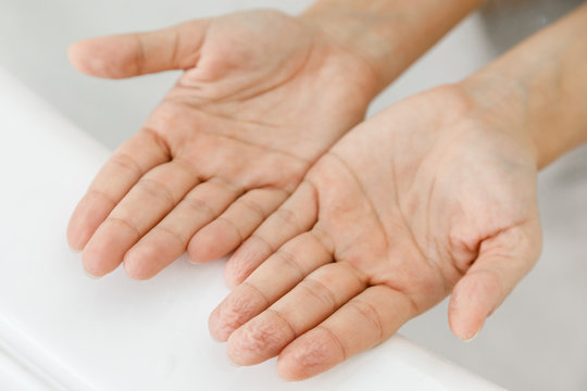 Female hands with wrinkles after bath