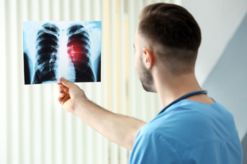 Doctor with x-ray image at hospital. Lung cancer concept