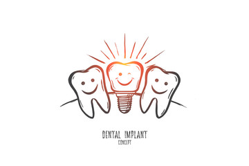 Dental implant concept. Hand drawn dental implant model. Implant tooth isolated vector illustration.